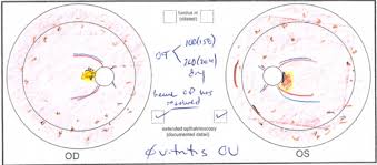 My Efforts As An Artist Learning To Draw The Retina Matt