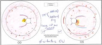 My Efforts As An Artist Learning To Draw The Retina Matt