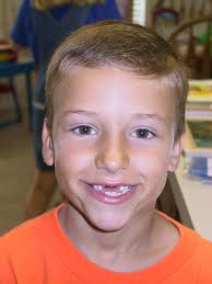 Dan loose tooth 02 7-02