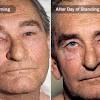 It's rare for lung cancer to be the cause of gynecomastia, but it's possible. Https Encrypted Tbn0 Gstatic Com Images Q Tbn And9gcr2l38sjvxgnqfoaxhx13w0qbmawwvcjrkhvwq1llxekd Gpagw Usqp Cau