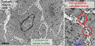 Necrosis may follow a wide variety of injuries, both physical and biological in nature. Animal Tissues Muscle Atlas Of Plant And Animal Histology