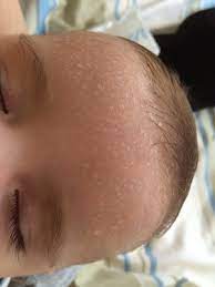 Mein Baby 6 Monate Alt Schwitzt Extrem Baby Gruppe Babycenter