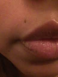 The piercer will start the process by cleaning the outer area with antibacterial substances. How To Remove Piercing Scars Is It Possible Beautylish
