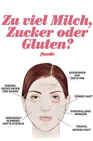 Zu Viel Zucker Milch Oder Gluten Ihr Gesicht Verrat Es Ihnen Freundin De Schonheitstricks Gesicht Haare Pflegen