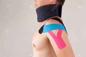 Diese Art Von Taping Heisst Kinesiotape Schmerzen Reduzieren In Manchen Fallen Kann Man Auch Den Muskel Tonisieren Kinesio Taping Zur Stabilisierung Der Schulter Lizenzfreie Fotos Bilder Und Stock Fotografie Image 86040065