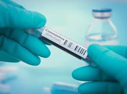 São testes de proximidade devem ser utilizados quando os testes de taan não estão disponíveis. Coronavirus Como Funcionam Os Testes Rapidos Que Detectam Anticorpos Vivabem Uol Vivabem