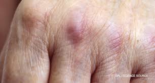 Image result for Oncinotis