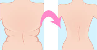 Le shrug ou haussement des épaules à la barre est un mouvement de musculation qui permet de travailler le faisceau supérieur des muscles trapèzes (haut du dos). Maigrir Du Dos Exercices Pour Raffermir Le Dos