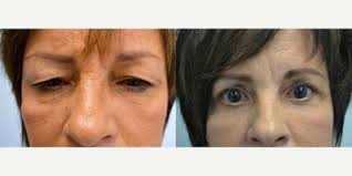 C. Jeff Kesler, MD, Board Certified Plastic Surgeon