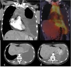 During the diagnostic process, imaging tests help identify tumors, tumor location and metastasis of cancer. Epos Trade