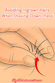 And, avoid shaving anywhere inside your labia majora. Avoiding Ingrown Hairs When Shaving A Down There