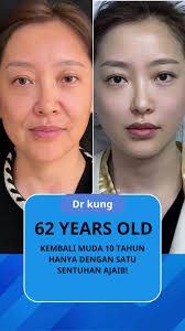 Indonesia Strangle Neck