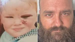 Out a window head first onto concrete': The lifelong impact of a childhood  fall