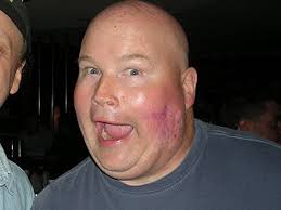 Competitive Eater 'Pat From Moonachie' Dead At 59, Fans Mourn Death