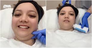 Leona buat rawatan kecilkan 'double chin', netizen pesan -"Jangan baiki  banyak sangat.."