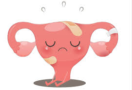 輕熟女因這病子宮比正常大兩倍經痛血崩像地獄！ - 婦科疾病IQ健康網