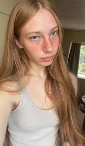 Most people make jokes about my skin. You too?