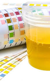 سهل القراءة إخماد يلطف المزاج خيوط بيضاء في البول عند الرجال comertinsaat com