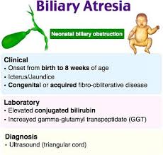 Berikut ini penyebab air kencing berwarna kuning pekat atau oranye. Dr Siti Sarah Aishah Suhaidi On Twitter Biliary Atresia Penyakit Di Mana Sistem Biliary Dan Salur Dlm Hati Tersumbat Sejak Lahir Lagi Tanda Penyakit Biliary Atresia Ialah Masalah Kuning Ataupun Jaundis Yang