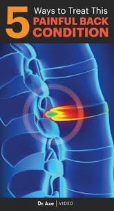 Pin On Back Pain