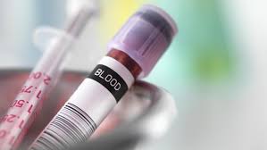 The complete blood count measures many important values pertaining to the blood cells. Interpreting The Complete Blood Count And Differential Elite Learning