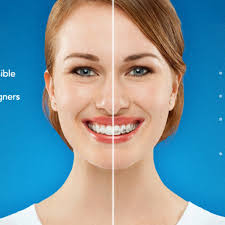 TOP 10 BEST Affordable Porcelain Veneers in Allen, TX, United States