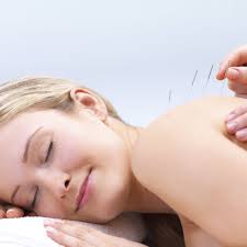 THE BEST 10 Acupuncture near Oak Ridge, Jefferson, NJ