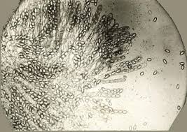 Image result for Vitellariopsis