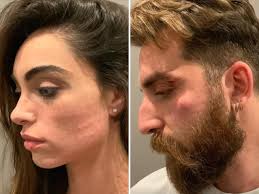 Lo scatto che ha pubblicato sui social è accompagnato da un dolcissimo. Lorella Boccia Ballerina Di Amici E Il Figlio Di Presta Aggrediti E Derubati Corriere It