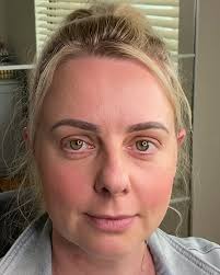 Healed OMBRÉ with a twist