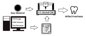 Flow Of The Dental Cad Cam System Download Scientific Diagram