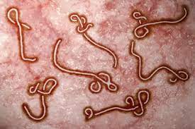 Buy ebola virus ebov ab to speed your study. How We Developed A Cheap Accurate On The Spot Test For Ebola