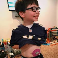 Ravens TE Mark Andrews has Type 1 diabetes and wants to inspire other kids  with it ✊ ◽️ Diagnosed at age nine ◽️ Only takes insulin pump off to play  ◽️ Tests