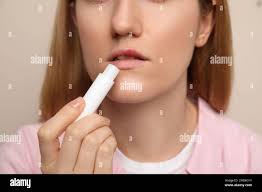 Swollen appearance hi-res stock photography and images