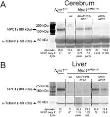 Image result for Black 1997 AAV