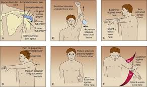 Image result for Shoulder Instability Exam