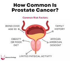 Image result for Prostate Cancer