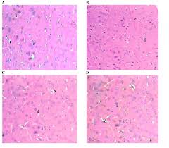 Image result for Pavetta crassipes