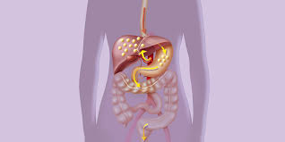 The right fats can make you thin for life ( $19.97, amazon ). I Ve Been Diagnosed With Gallbladder Polyps