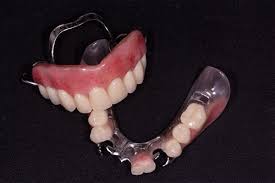 Protese Parcial Fixa I Especializar Protese Dental