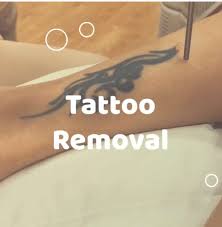 So to do you all a solid, i put together a list of. Tattoo Removal Veo Clinic