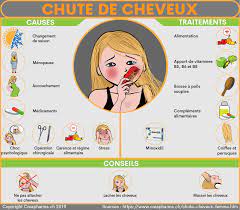 Si vous rencontrez une perte de. Chute De Cheveux Chez La Femme Creapharma