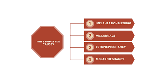 Image result for First Trimester Bleeding