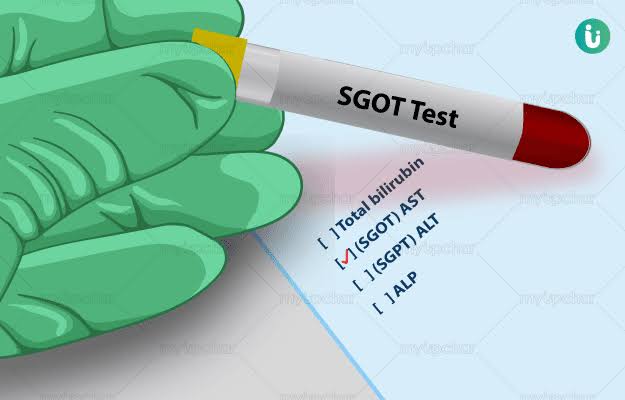 SGOT product image