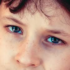 At somerset eye care, we aim to make the world a better place by taking care of our patients the way we'd want. Eyes Can Be An Access Point For Germs Somerset Nj Franklin Family Eyecare