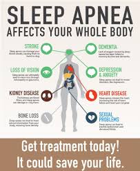 Image result for Sleep Apnea