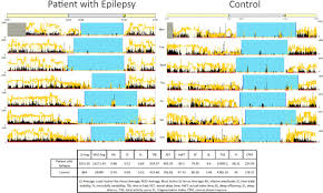 Image result for Actigraphy