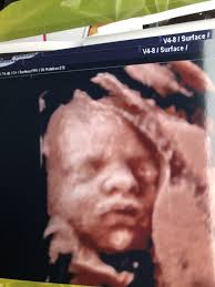 Check spelling or type a new query. 27 Week 3d Ultrasound Show Yours December 2018 Babies Forums What To Expect