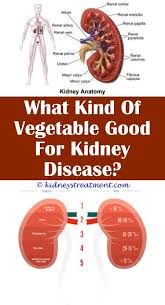 Signs Of Kidney Stones In 2020 Kidney Disease Recipes Kidney Disease Awareness Kidney Diet