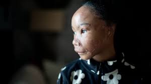 Dogs attacked, nearly killed Ohio girl. Now, her mom fights for reform